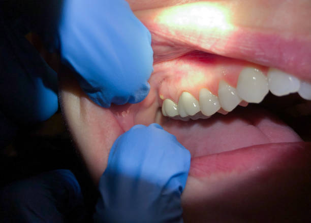 Best Emergency Gum Pain Relief  in Big Rapids, MI